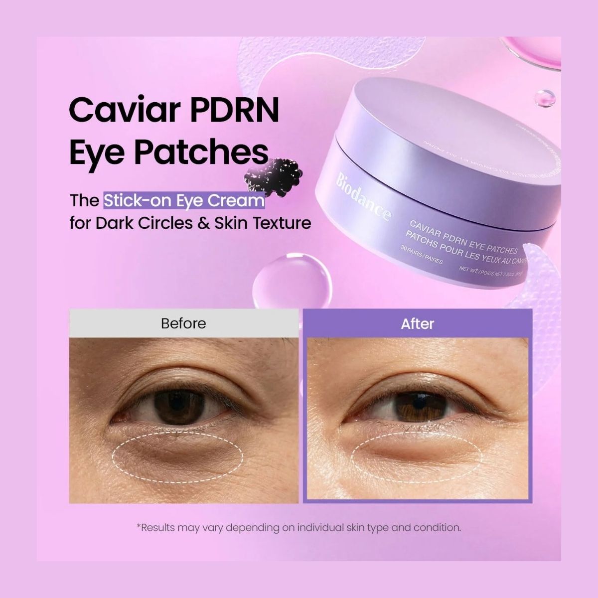 Caviar PDRN Eye Patches
