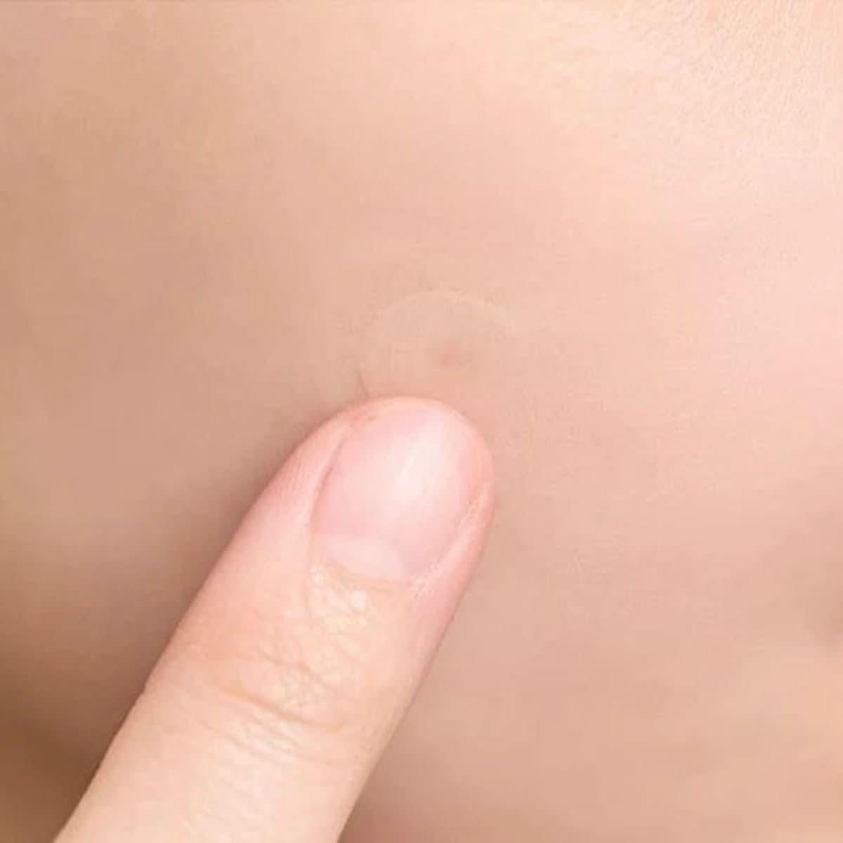 SKIN1004 Tea - Trica Spot Cover Patch Korean Skincare | VELVET GLOW