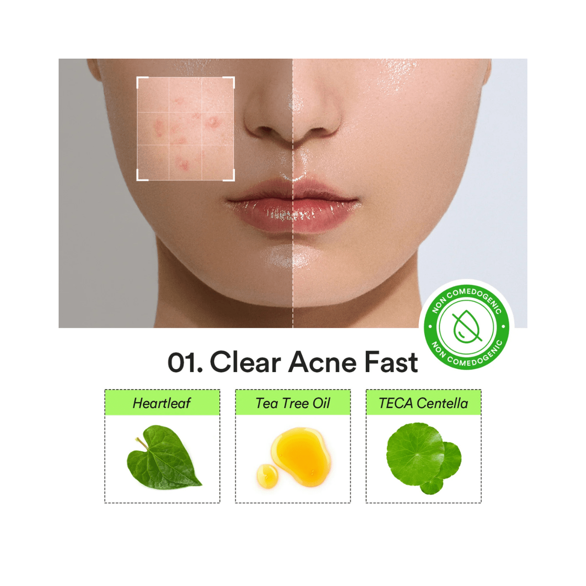 Abib Heartleaf Calming Spot Patch Korean Skincare | VELVET GLOW