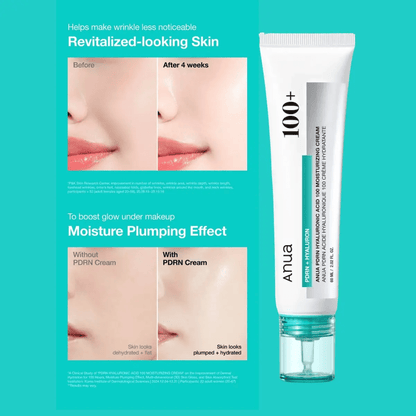 Anua PDRN Hyaluronic Acid 100 Moisture Cream Korean Skincare | VELVET GLOW
